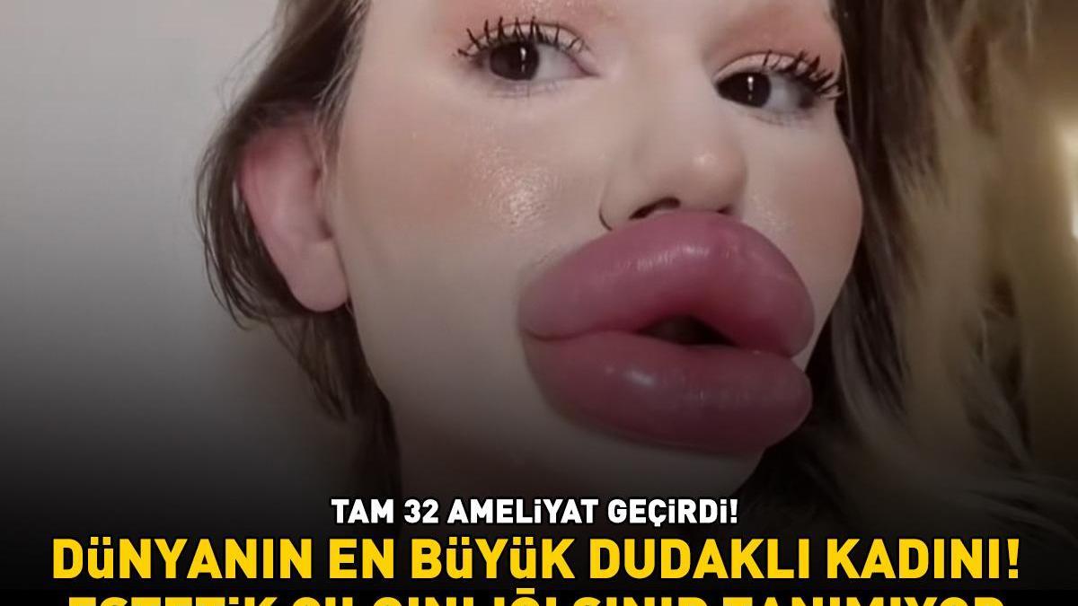 Dünyanın en büyük dudaklı kadını! Tam 32 ameliyat geçirdi! Uzmanlar uyarıyor: ‘Estetik çılgınlığı sınır tanımıyor!’